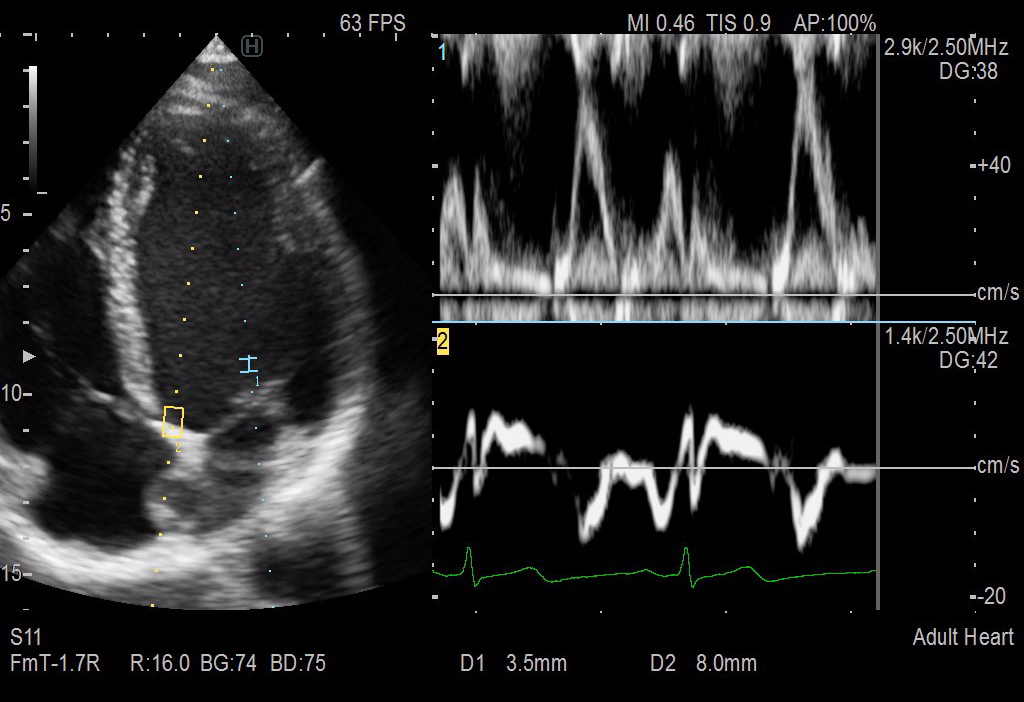 Cardiology-0008-3