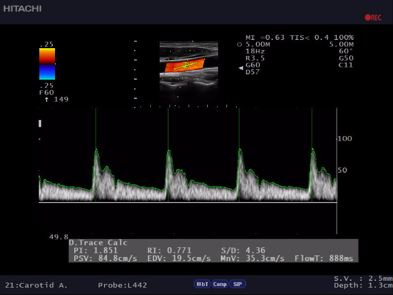 auto-trace-ar50